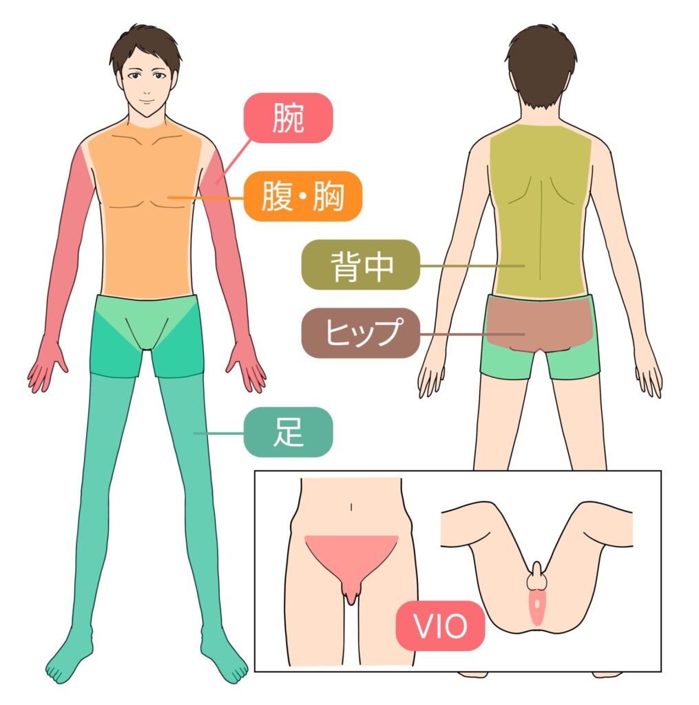 都度払いの脱毛の部位